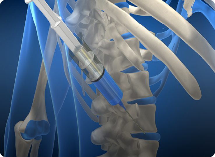 비수술치료이미지